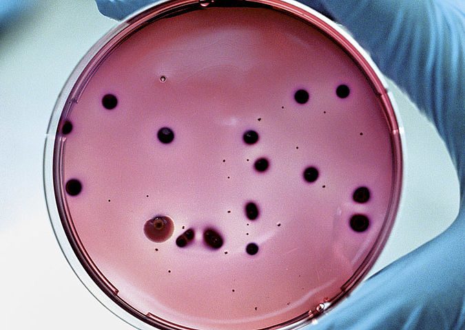 Placă Petri pentru analiza microbiologică a alimentelor